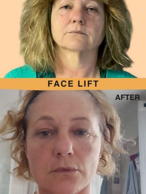 photo_10_2024-05-09_11-56-45