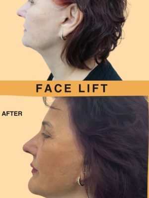 photo_14_2024-05-09_11-56-45