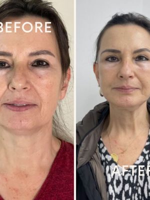 photo_2023-07-31_15-53-43